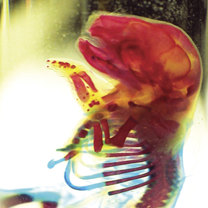 Digital Photograph of a Foetal Animal by Howard Forbes